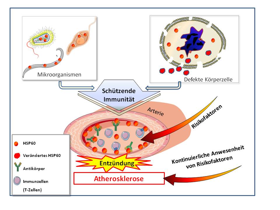 Die Autoimmunitätshypothese der Atherosklerose
