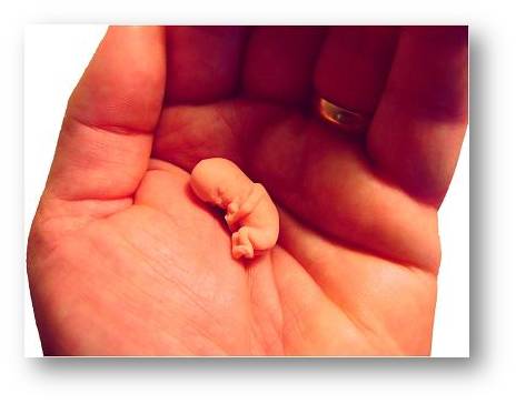 Magideal 9 Monat 1 1 Menschlichen Fötus Embryonalen Entwicklung Modell 